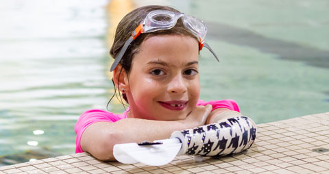 Une enfant amputée portant son bras artificiel pour l’eau dans une piscine.