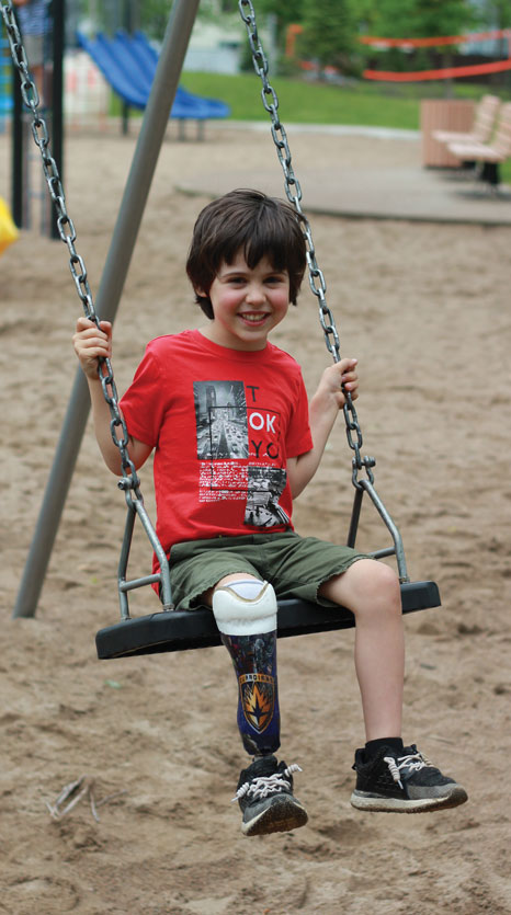Un jeune garçon amputé d’une jambe est assis sur une balançoire et affiche un grand sourire.