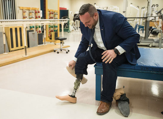 Un homme adulte amputé d’une jambe est assis sur un banc dans le bureau d’un prothésiste.