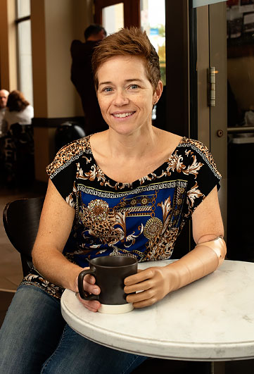 Une femme amputée d’un bras est assise à une table dans un café et tient une tasse.