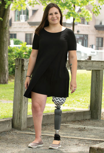 Une femme amputée d’une jambe marche dans un parc. 