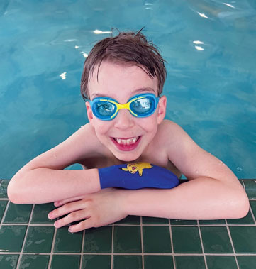 Un jeune garçon ayant une amputation partielle de la main porte des lunettes de natation et repose ses bras sur le bord d’une piscine.