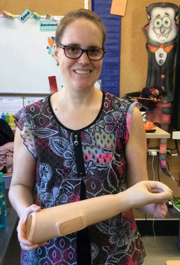 Une femme amputée d’un bras tient un bras artificiel dans une salle de classe.