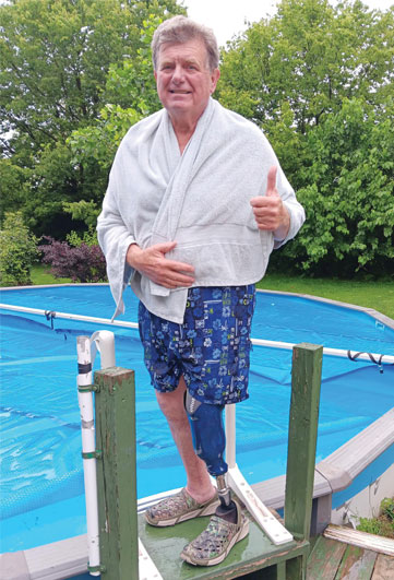 Un homme aîné amputé d’une jambe est debout à côté d’une piscine dans une cour arrière.