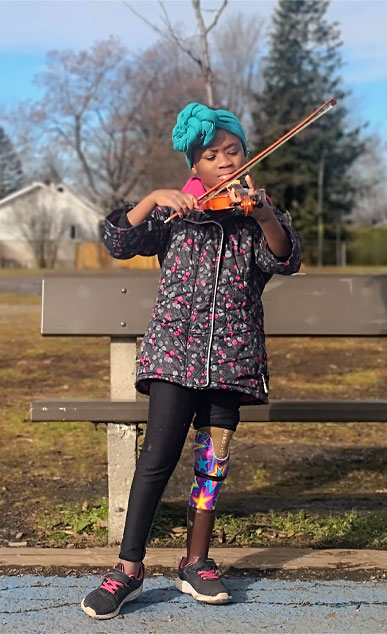 Une jeune fille ayant plusieurs amputations joue du violon en étant debout dans un parc.