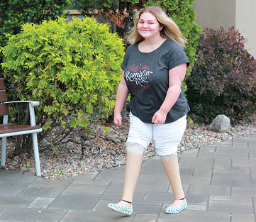 Megan, amputée des jambes, marche sur le trottoir à l’aide de ses jambes artificielles.