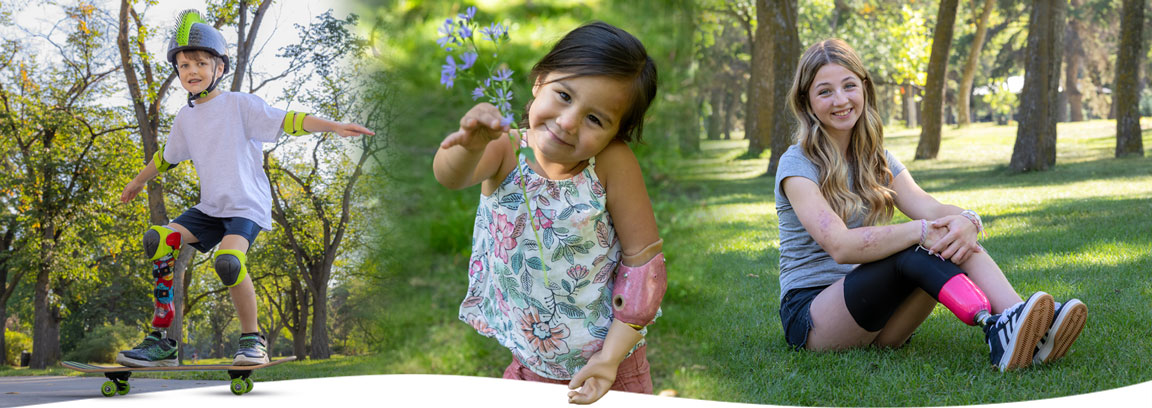 Un montage de photos montrant de jeunes amputés à l’extérieur qui portent un membre artificiel.