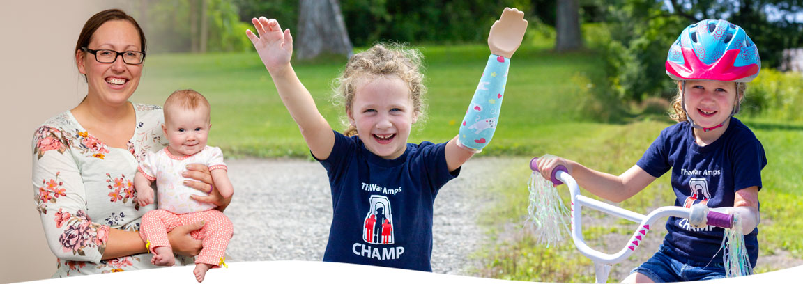 A photo collage of Vanessa, a young arm amputee, at different ages wearing her artificial limb and participating in activities like riding her bike.