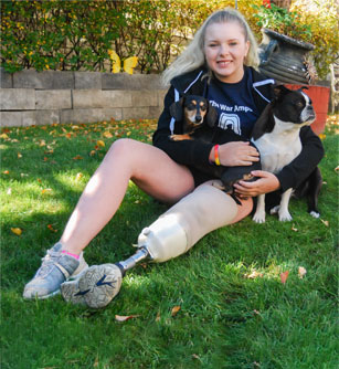 Champ Kennedy, a leg amputee, sitting on a lawn with her two dogs.