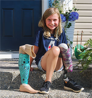 Champ Zoe, a leg amputee, sitting on her front porch.